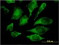 MAPK13 / p38delta Antibody (clone 1E11)